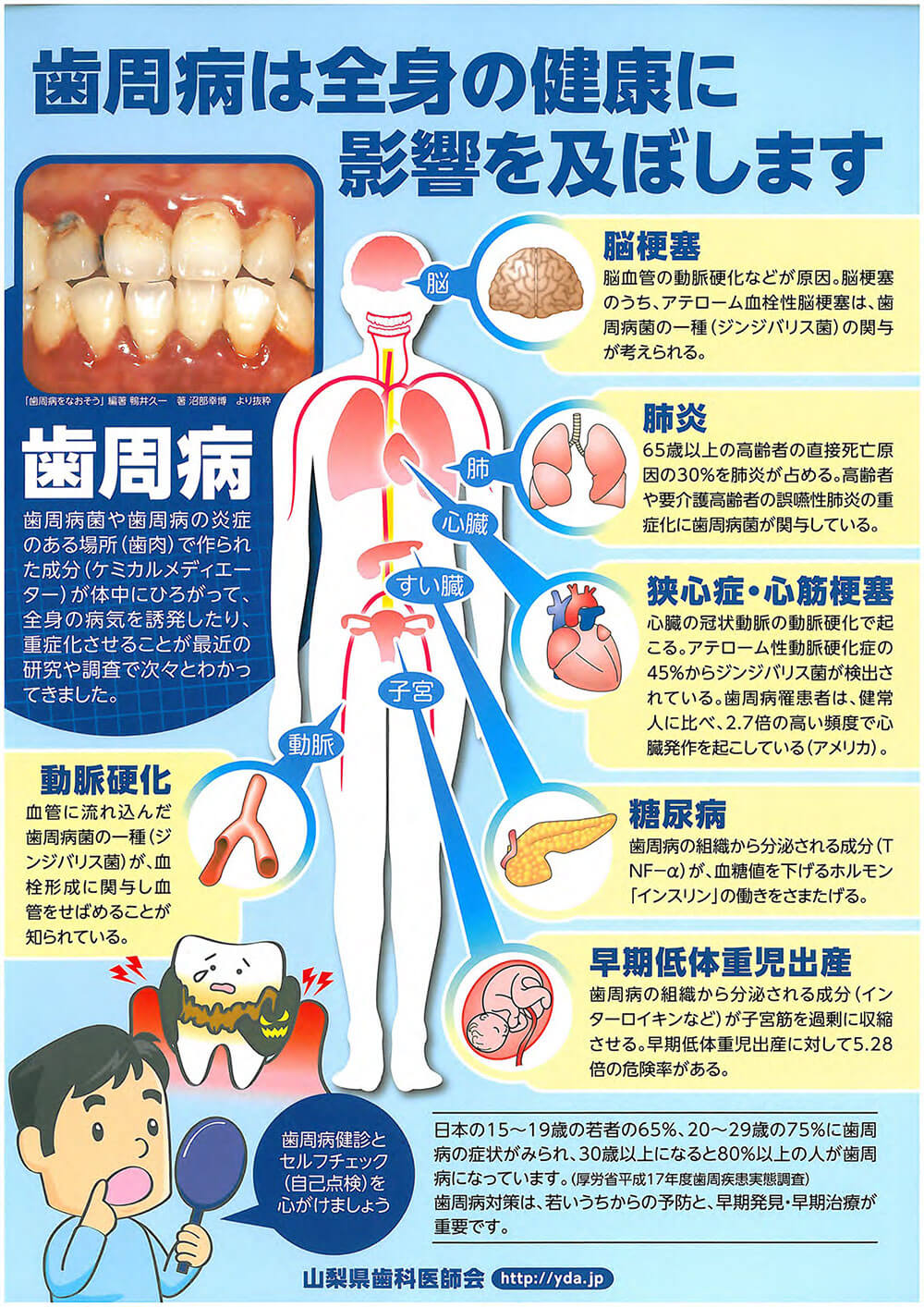 歯周病は全身の健康に影響を及ぼします