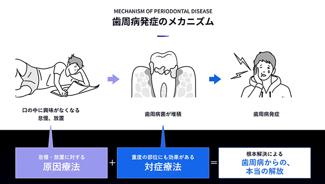 歯周病発症のメカニズム