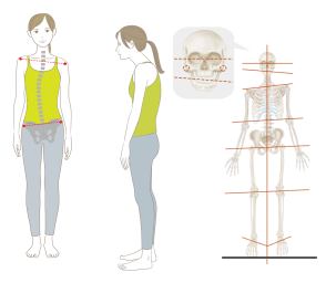 体の歪みがある状態のイメージ