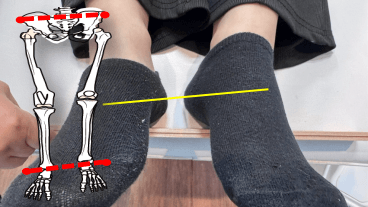 足の長さのずれの写真