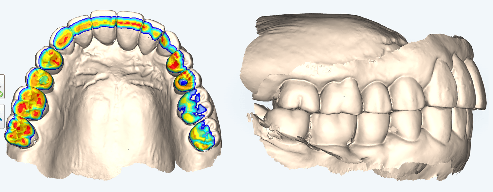 顎の位置（通常で咬んでいる状態）