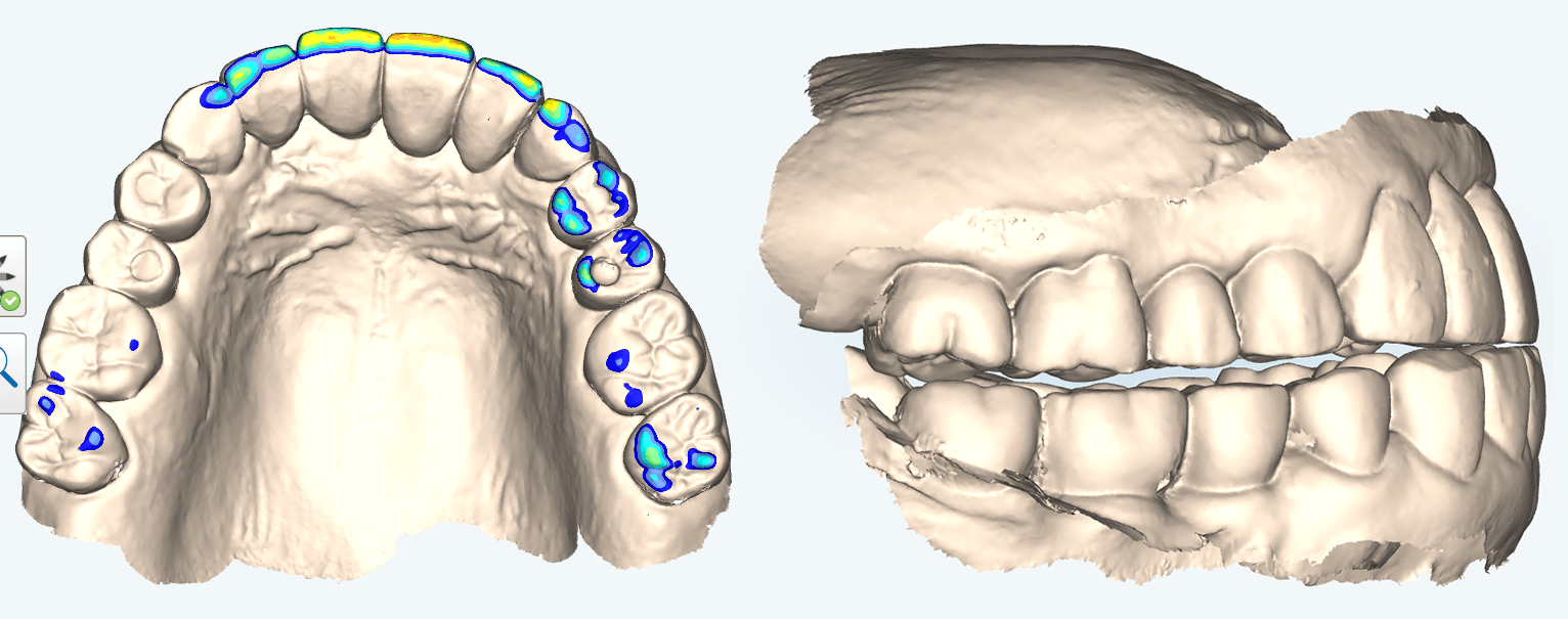 顎の位置（整体後）
