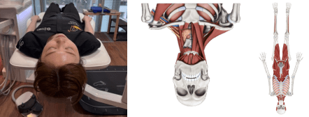 体の歪みの確認