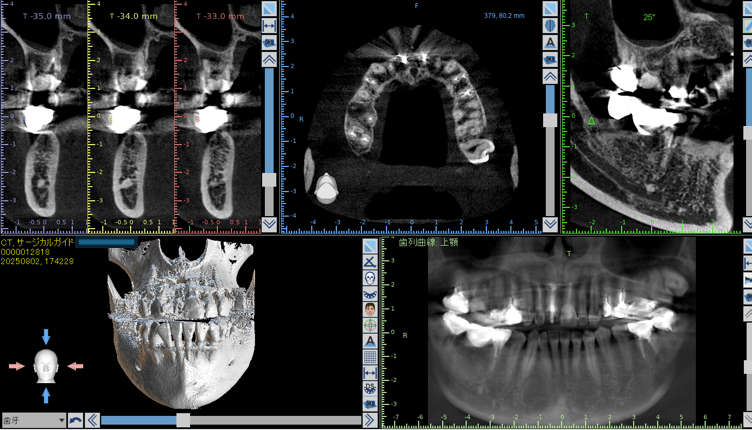骨と歯の位置関係を診査します