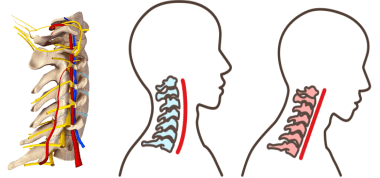 シン中心位で記録すると頸椎の角度が変わっています