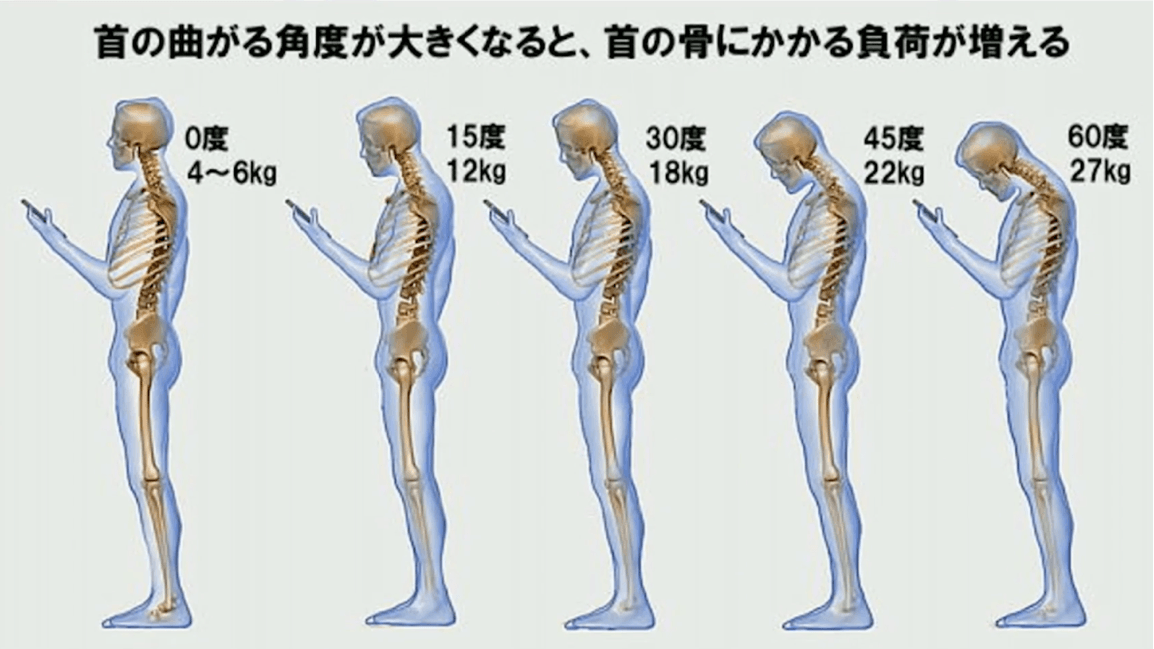 首の曲がる角度が大きくなると、首の骨にかかる負荷が増える