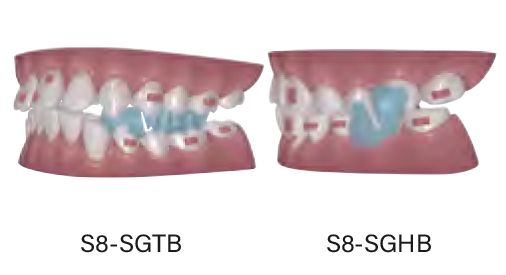 下顎整位下顎前方誘導装置