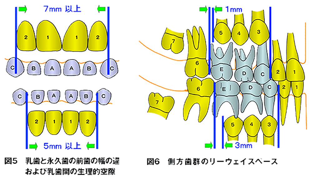 乳歯と永久歯の前歯の幅の違いおよび乳歯間の生理的空隙　側方歯群のリーウェイスペース