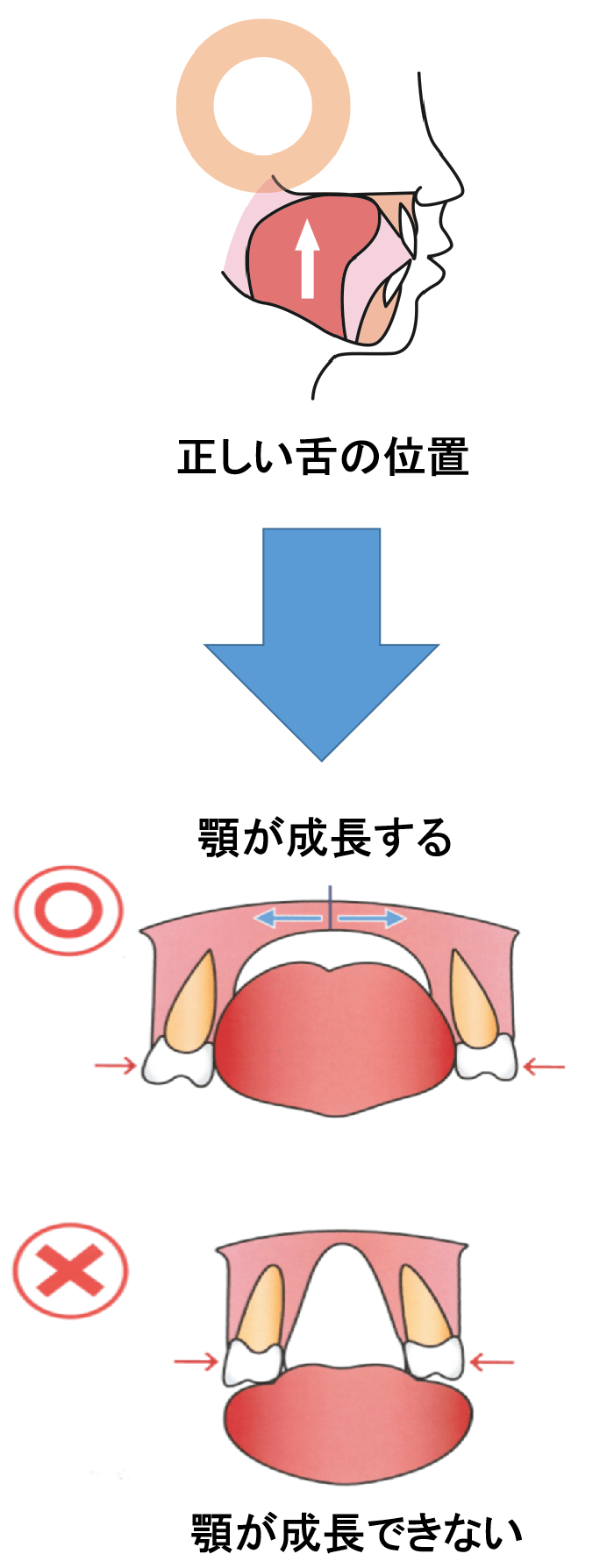 舌が正しい位置にあると