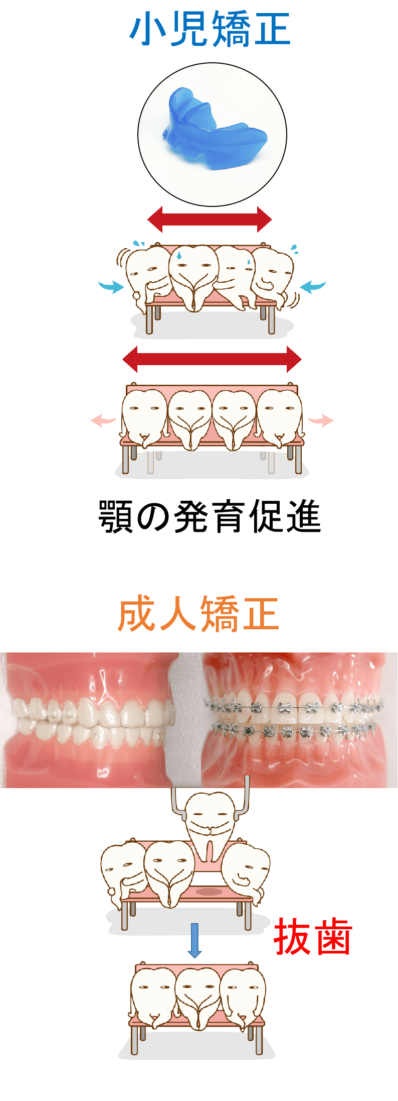 小児矯正・成人矯正　どちらの矯正治療が良いですか？