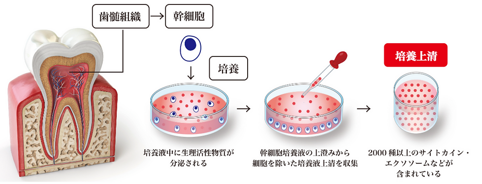 培養上清作り方